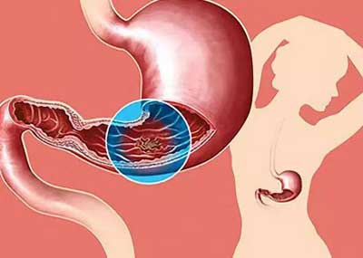 �����ھ���ע��Ӳ�������ƷǾ�