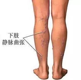 ��֫�������ŵľ۹���ĭӲ��