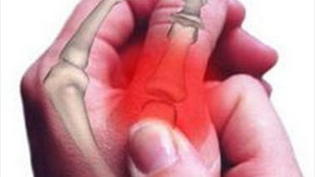 ����ؽ��ײ����಻���Ӱ������