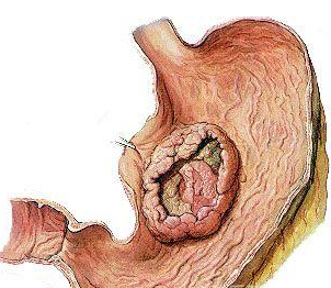 ����θ�������ô�����