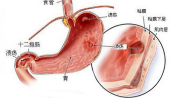 ����θ����񻯻�����Щ����
