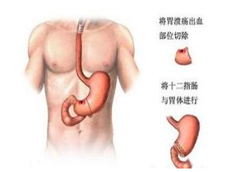 ���＾�ڽ����ʱ������θ��Ѫ