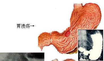 ����θ��������ô����?�����Щ�����й�ϵ