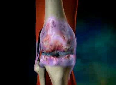 Ҫ����Ԥ��ʹ��ؽ��ף�