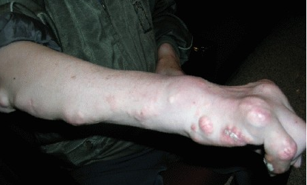 ʹ�综����ʲô������ʳԭ��