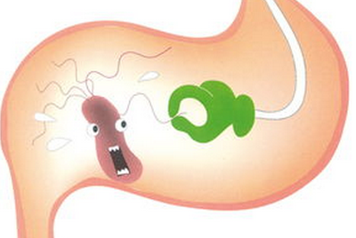 ����θ��׻����ʲô����֢״