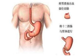 ���ڵĸ���ҪС��θ��Ѫ