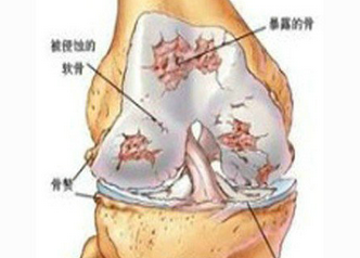 Ҫ�������ܰ��ѷ�ʪ�ǲ�