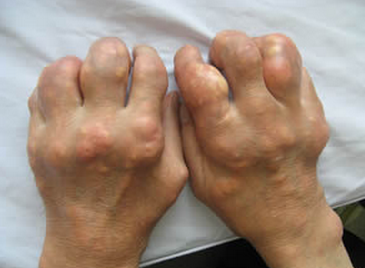 �Թ�����տ�С�ƾͻᵼ��ʹ��