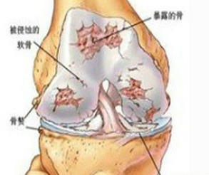 ��ʪ�ǲ��ؽ���Ҫ����������ѵ��