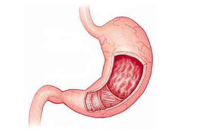 ���ﵼ��θ��׵���Ҫԭ��