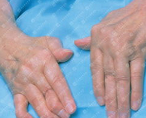 �����ʪ�ǲ������Ʒ�������Щ