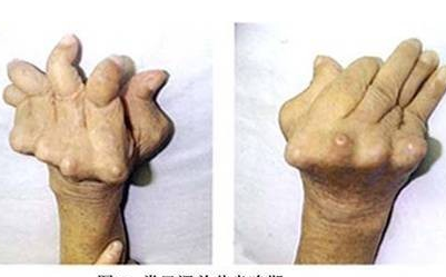 ��ҽ���Ʒ�ʪ�ǲ��İ취