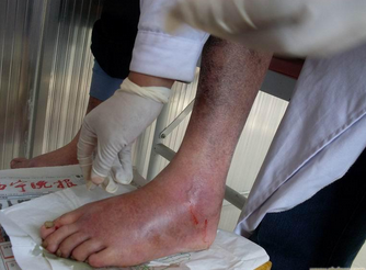 ��ʱ���β��÷�ʪ�ǲ�������ʲôԭ��