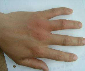 Ҫ����ȥ��ʶ��ʪ�ǲ�