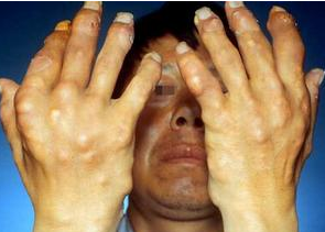 ���쳣������ʹ���ԭ��