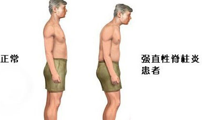 û�м�ʱ����ǿֱ������޷�����ĺ��