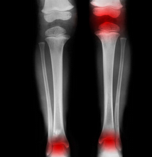 �����ķ�ʪ�ǲ���ʲô