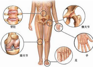 �������ƹؽڼ���������