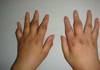 ����Ϊʲô�����ӷ�ʪ�ǲ��ķ���