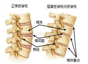 ǿֱ�Լ����������ڳ��ֵ�����ǳ���