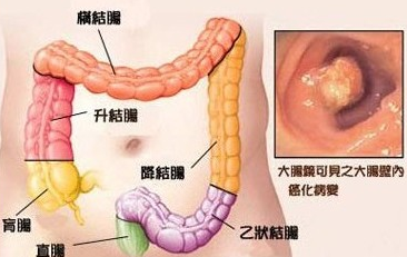 �᳦����һ��ʲô���ļ���