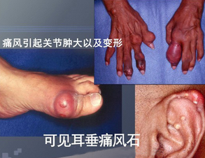 ʹ�综���������и���ι淶����ʳ