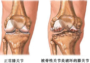 ������˹ؽ��׾Ͳ���ͻ�ʹ�ؽ�����