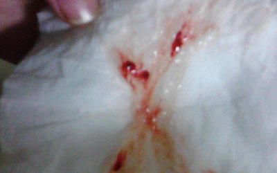 ����Ѫ֮���д�Ѫ