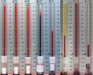 Ѫ�����Ƿ�ʪ�ǲ���