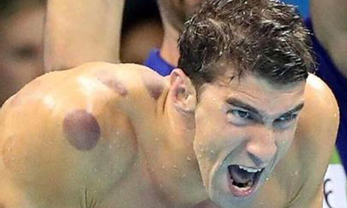 �ι޵İ��˹ھ�