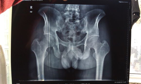 ǿֱ�Լ�����